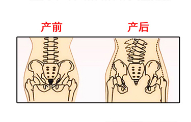 月子期間盆骨儀器修復(fù)時(shí)間有限制嗎？與手法修復(fù)相比哪個(gè)效果好？